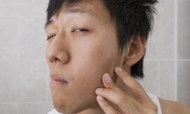 10 Consigli Contro L’Acne
