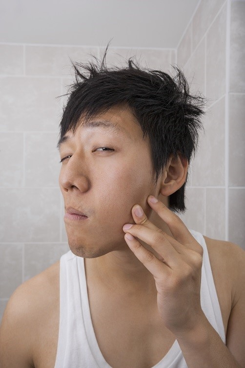 Scopri di più sull'articolo 10 Consigli Contro L’Acne